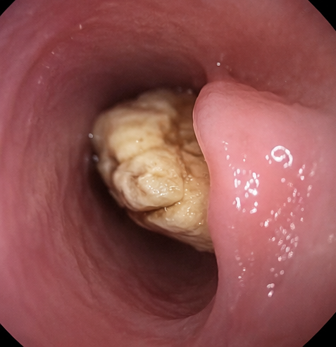 k3 kidney